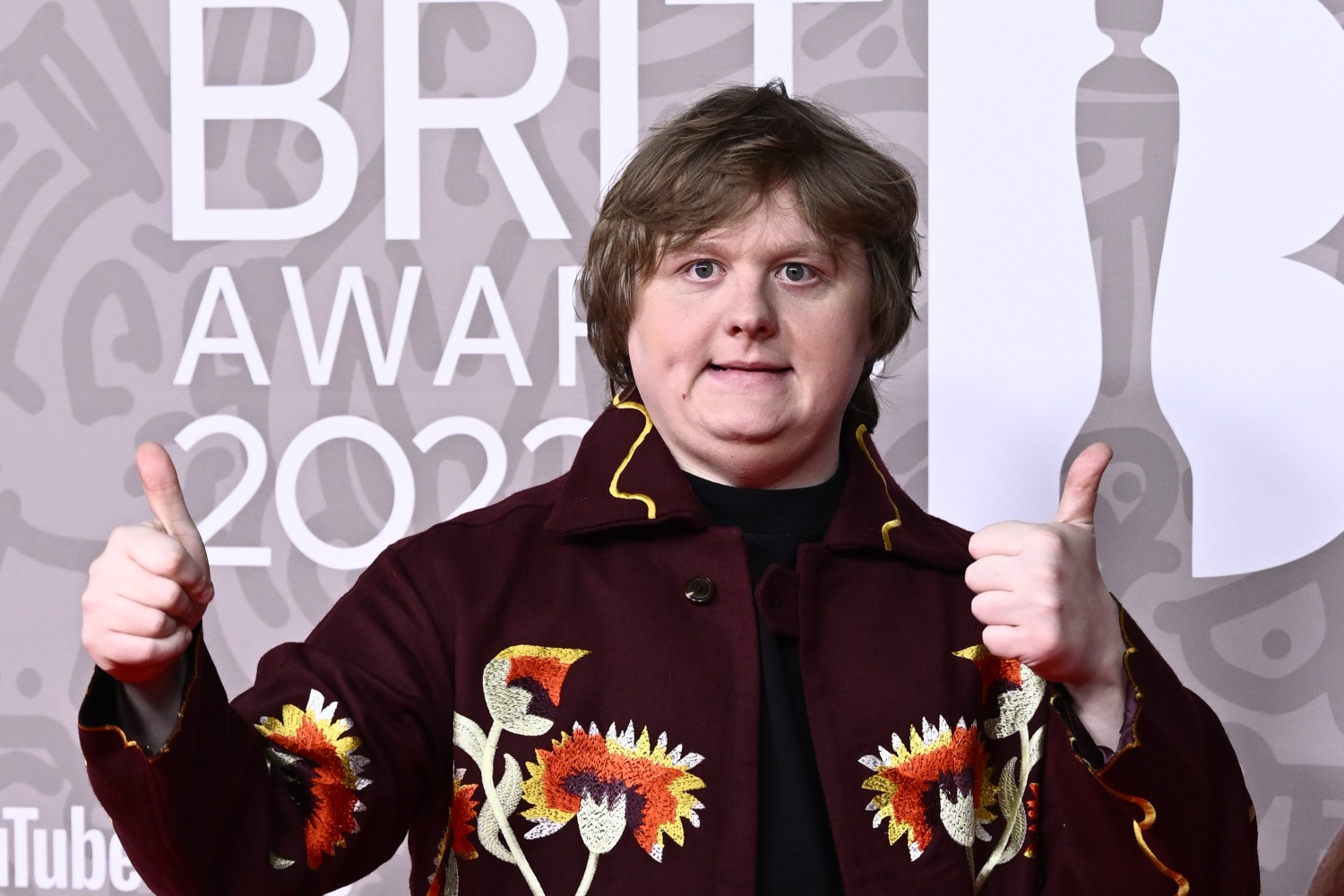 Lewis Capaldi Shares Heartbreaking Update on His Music Return Months After Announcing Hiatus