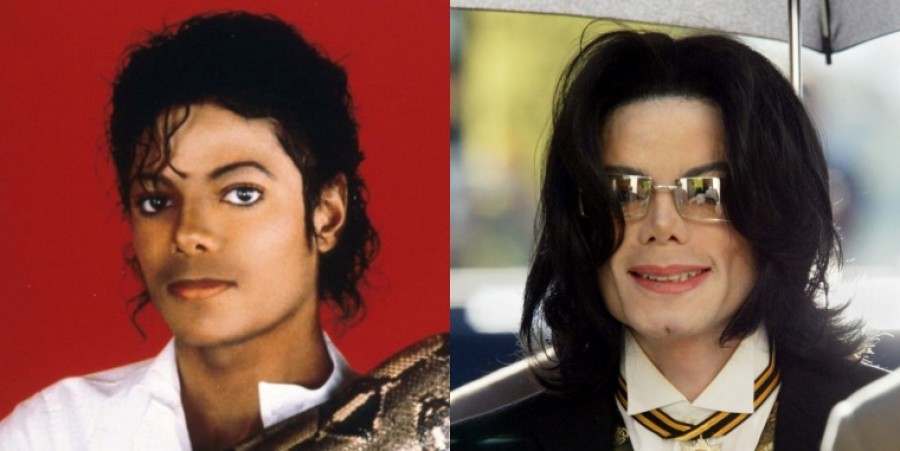 How Did Michael Jackson's Skin Turn White As He Got Older?