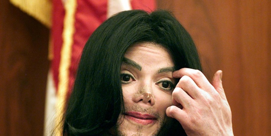 'Insecure' Michael Jackson Suffered Because of Blotchy Skin Caused by Vitiligo, His Son Reveals