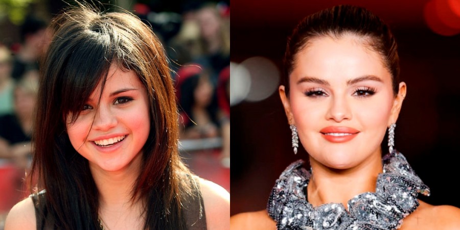 Did Selena Gomez Undergo Plastic Surgery? Singer Reveals Truth